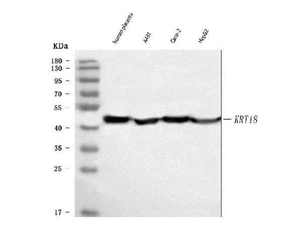 Western blot analysis of Cytokeratin Peptide 18